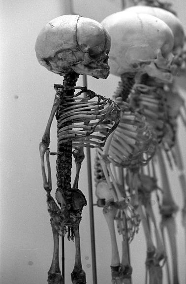 skeletonscowl.jpg
